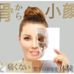 キュっと引き締まったV字小顔になれるフェイシャルが今人気の月額サブスク